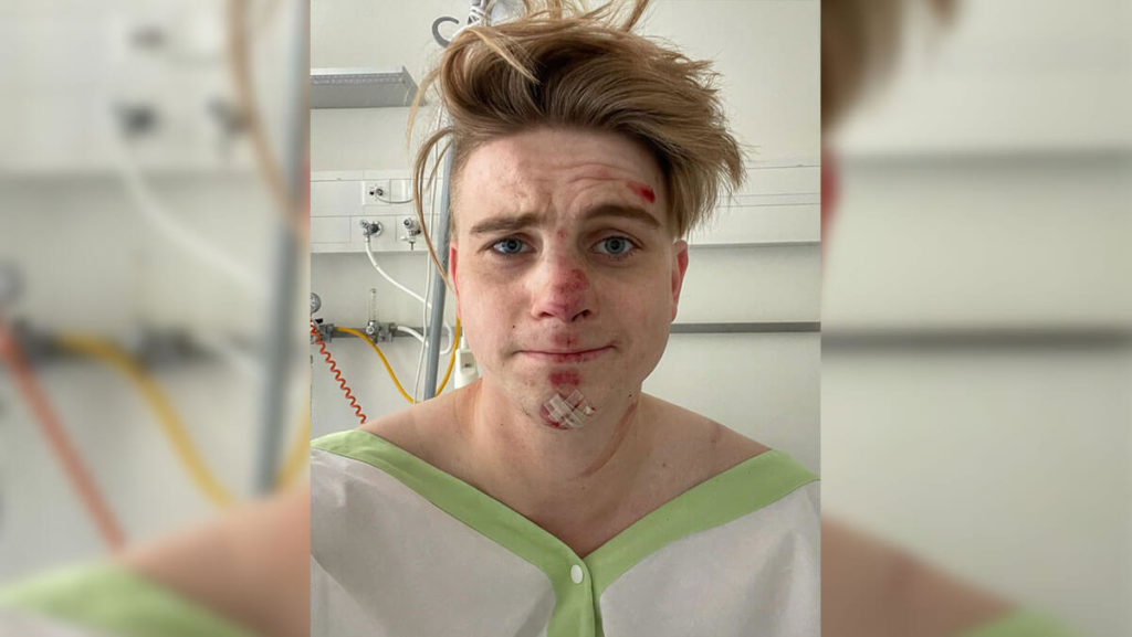 Vincent Gross: Schwerer Unfall