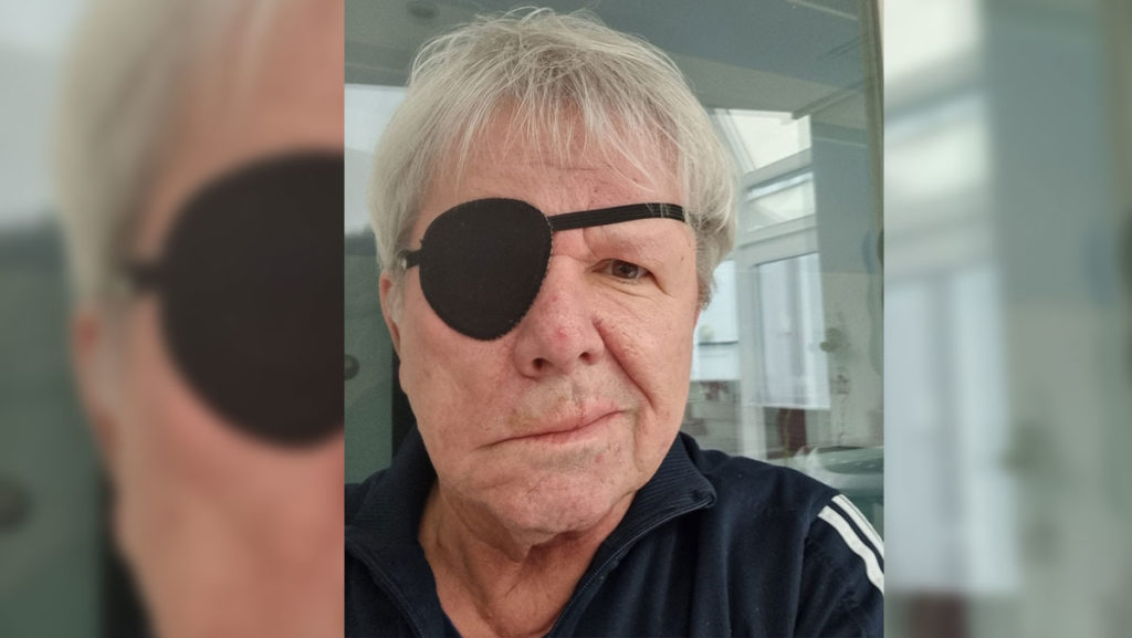 G.G. Anderson kämpft gegen Gesichtslähmung